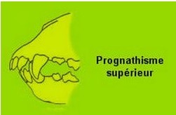 prognathisme superieur